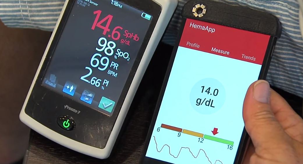 Google acquisisce Senosis Health e si prepara a rivoluzionare la telemedicina