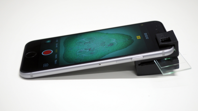 Inventato un microscopio stampato in 3D per smartphone