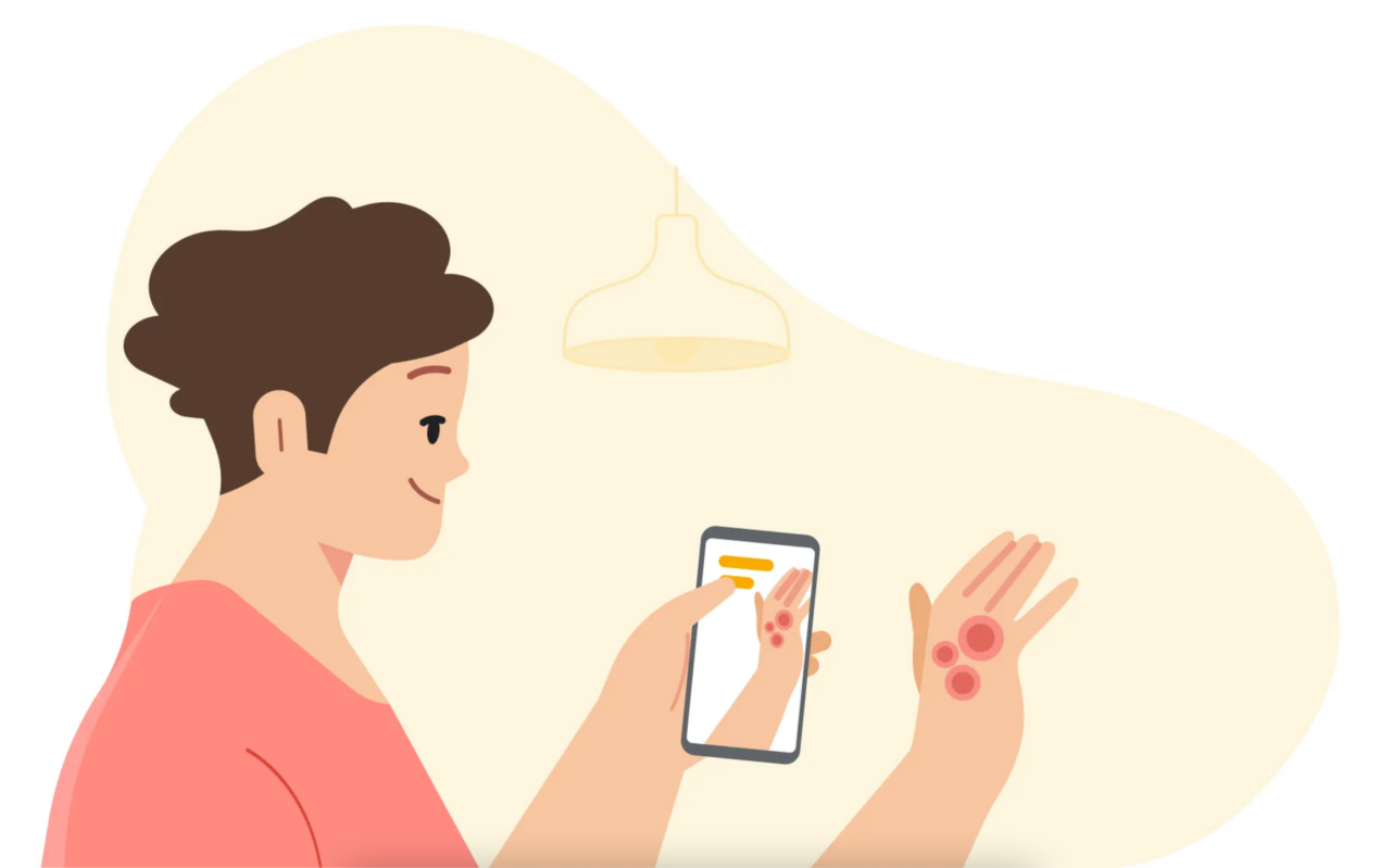 Google brevetta un sistema di IA per diagnosticare le condizioni della pelle