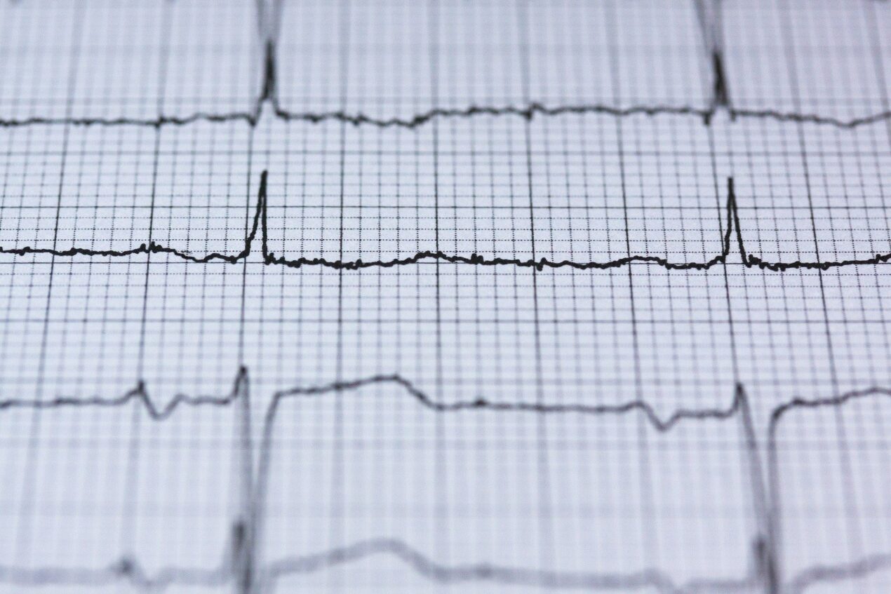 In futuro il battito cardiaco potrebbe sostituire le impronte digitali nell'identificazione biometrica