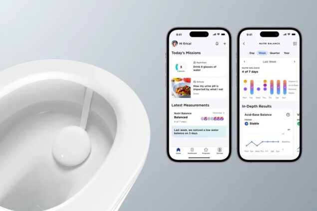 Withings U Scan
