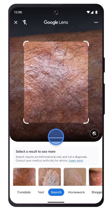 Google Lens analisi pelle