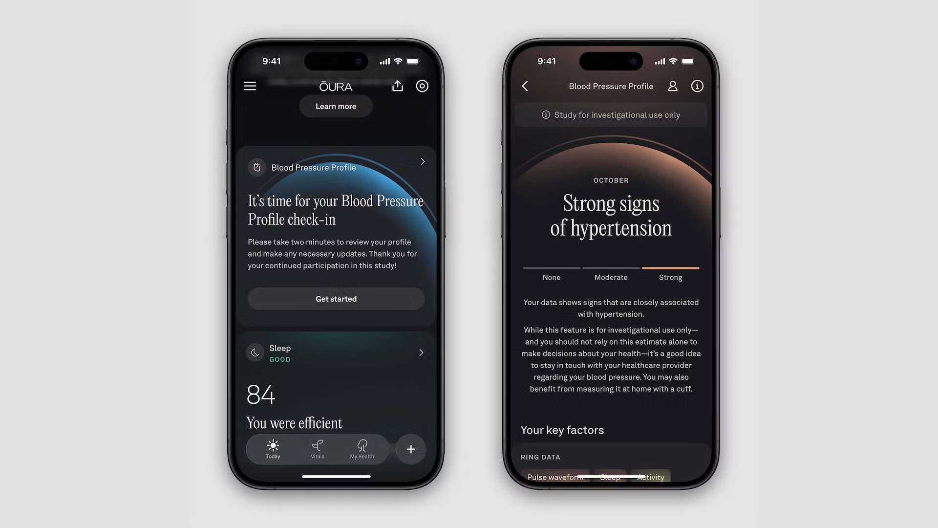 App Oura - novità ottobre 2025 - Studio profilo pressione sanguigna