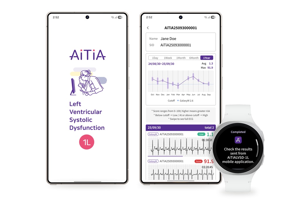 Samsung Galaxy Watch segnali precoci scompenso cardiaco